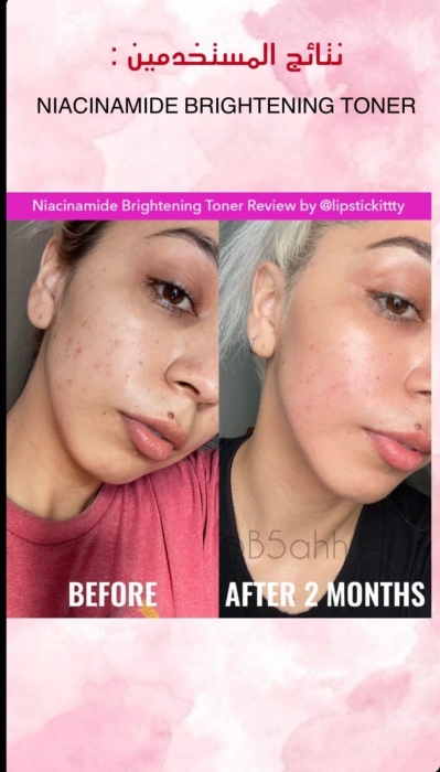 Good Molecules, Niacinamide Brightening Toner